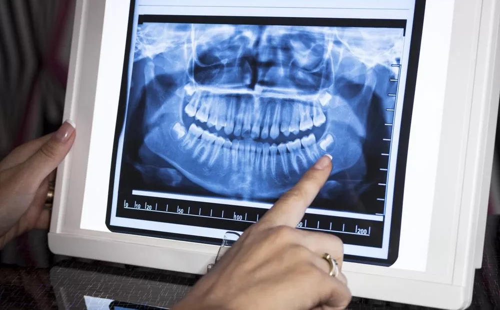 Digital-XRay-Dental